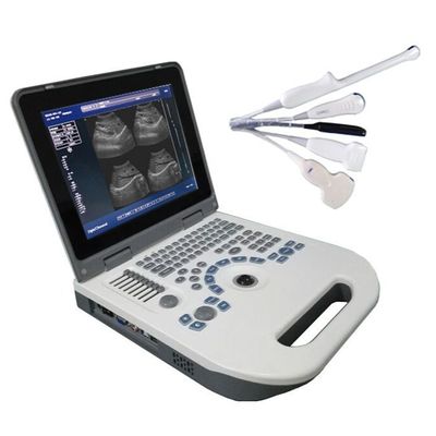 Качество  TGC Control Notebook Ultrasound Scanner For Pregnancy Home Use Фабрика