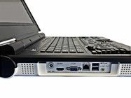 15-дюймовый светодиодный цветный портативный ультразвуковой аппарат с 60-градусным углом сканирования и конфигурацией зонды 2.0MHz-5.0MHz