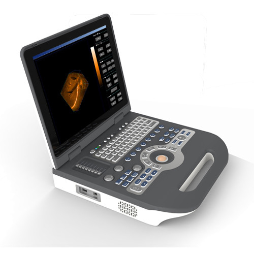 Ультразвука цвета 4D Eco машина Ultrasonography цифров медицинского портативная