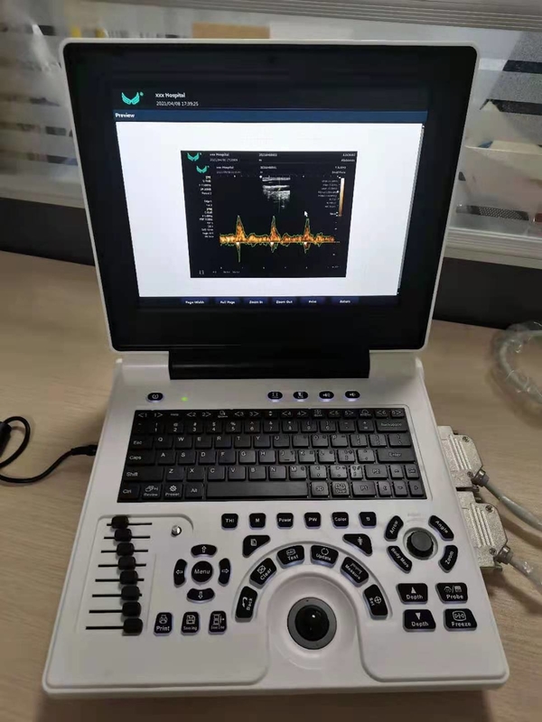 Ультразвук Doppler цвета беременности Xianfeng подвергает OEM механической обработке изображений 4B