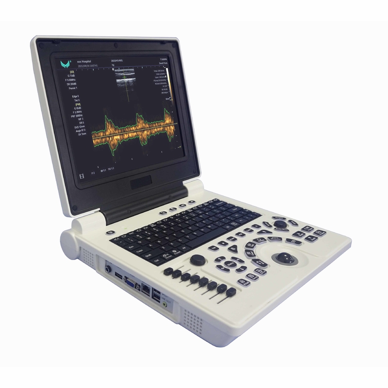 Ультразвук Doppler цвета беременности Xianfeng подвергает OEM механической обработке изображений 4B