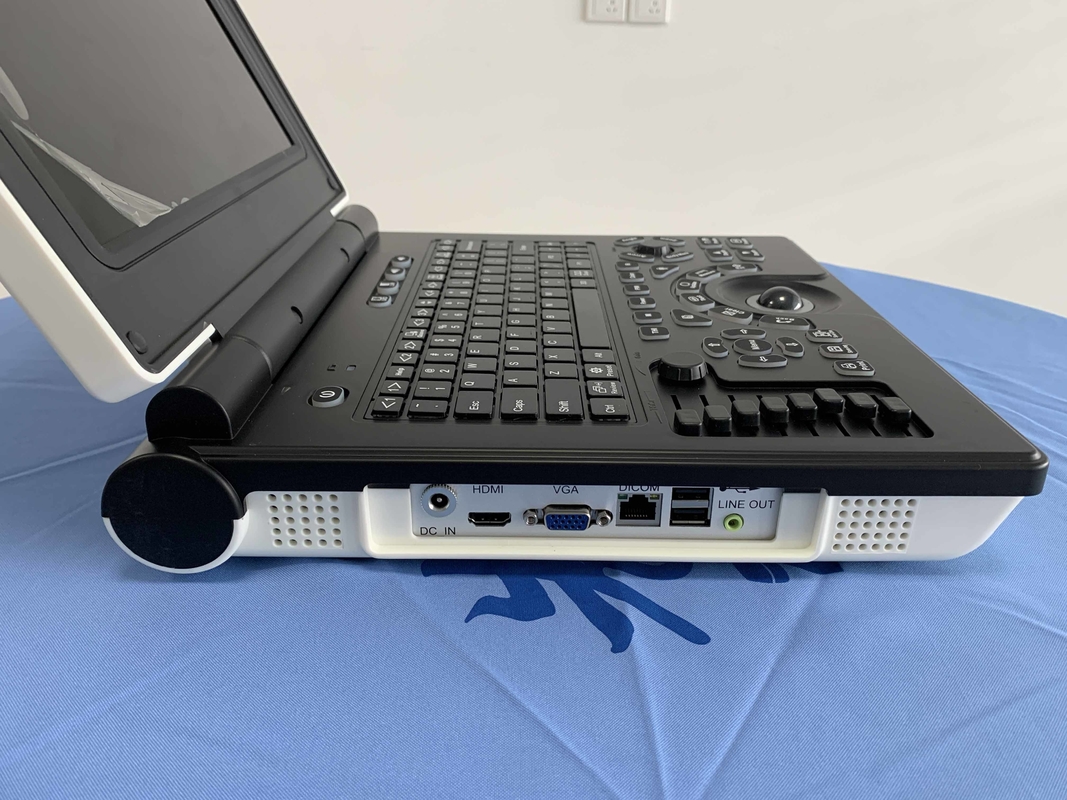 Батарея блока развертки 3200mAh ультразвука Doppler цвета системы Win7 портативная