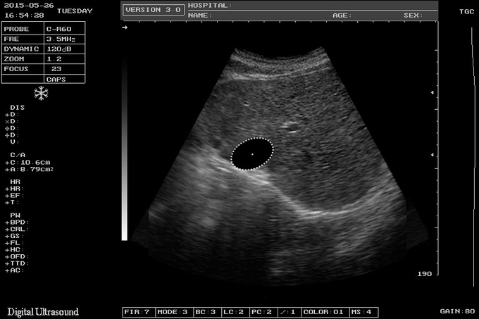 Машина развертки тетради USG развертки электрона ISO на акушерство и Gynecology 8