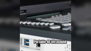Портативный 4D-допплеровский ультразвуковой аппарат готов к работе в отделении интенсивной терапии