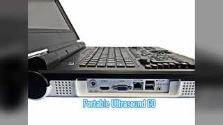 Портативный цветной допплеровский ультразвуковой сканер E0 для урологии